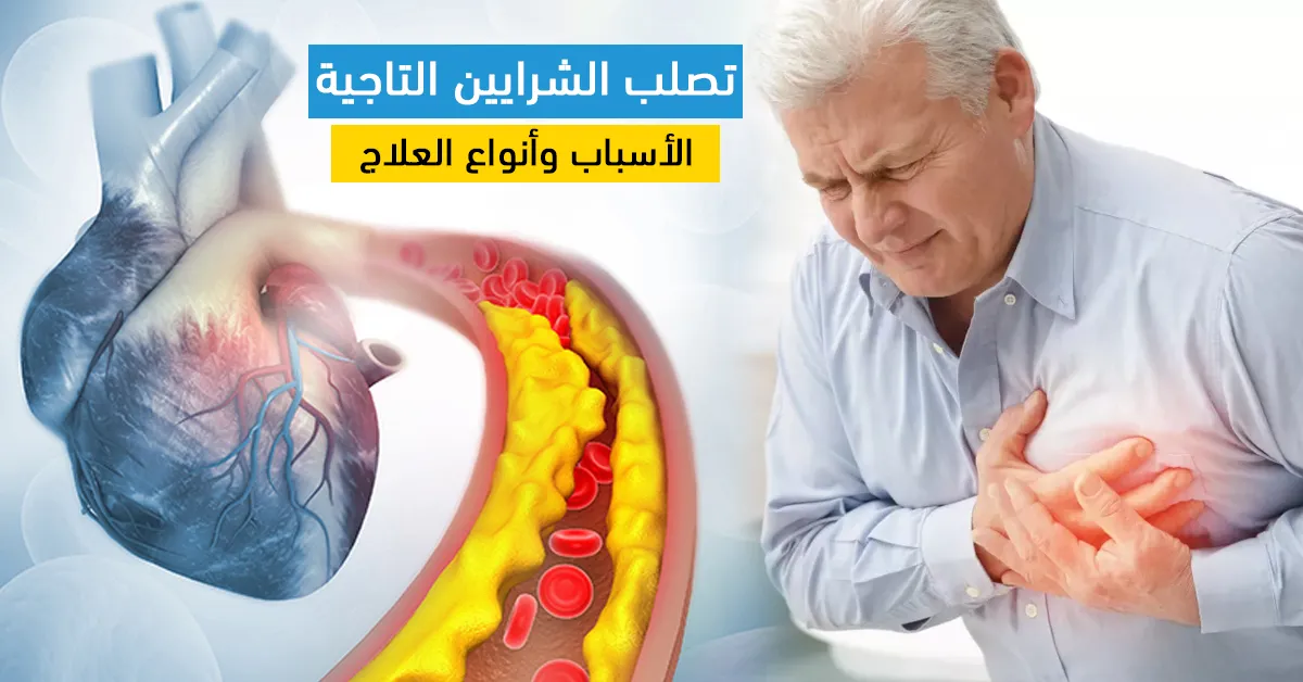 تصلب الشرايين التاجية : الأسباب وأنواع العلاج